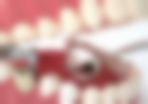 即刻种植牙有什么好处和坏处