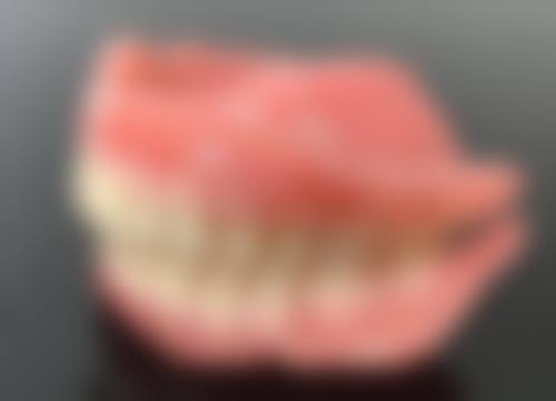 口腔颌面外科拔牙是否需要了解患者的全身状况