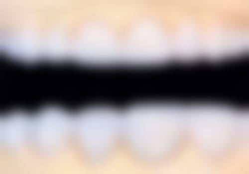 【海口龙华笛特口腔门诊部参考价格表：】