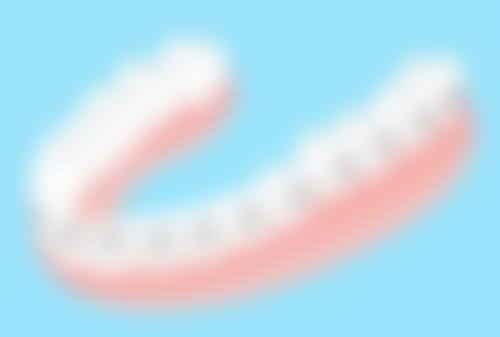 种植牙的安装过程