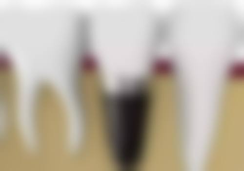 【尹万洋医生技术特点】