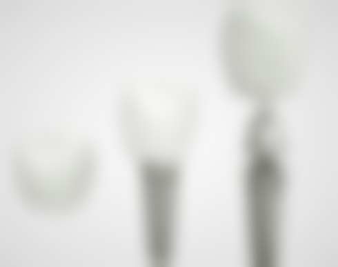 种植牙的义齿如何安装？详细步骤大揭秘，4大关键要点助你了解安装全过程！ 