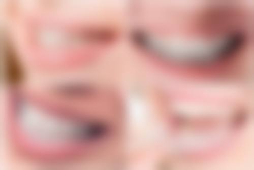 50岁后可以做牙齿矫正吗图片