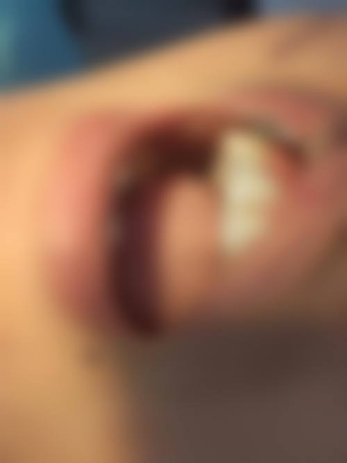 【陈情医生擅长项目】