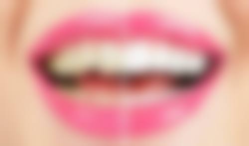 【玉龙华雅口腔诊所是正规的吗?】