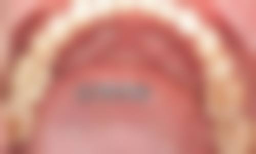 【曹丽华医生擅长项目】