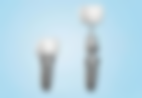 种植与活动假牙、烤瓷牙的区别