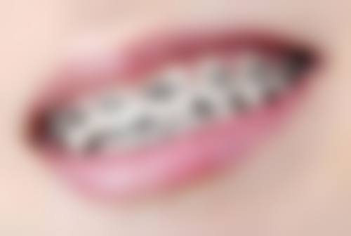 重度骨质疏松可以种植牙吗