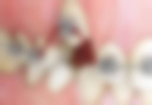 【成都圣丹福口腔患者口碑评价:】