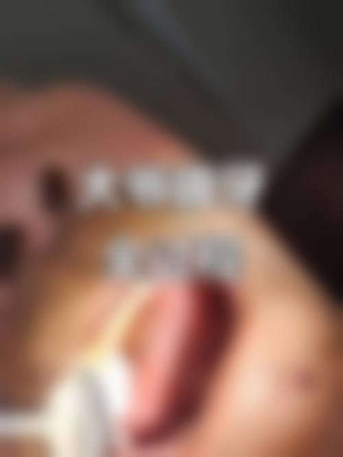 【郝新青医生口碑怎么样？】