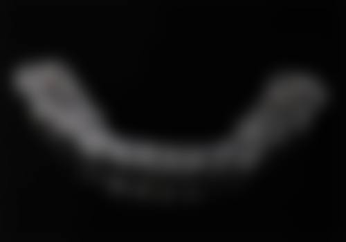 【广东汕头潮阳爱雅口腔怎么预约挂号?】