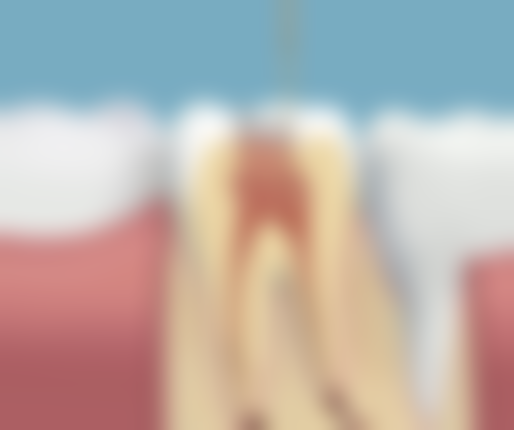 地包天自己矫正小妙招