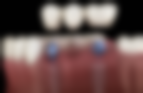 【孙悦医生擅长项目】