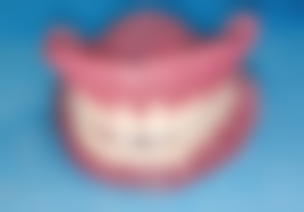 全瓷牙松动怎么修复牙齿