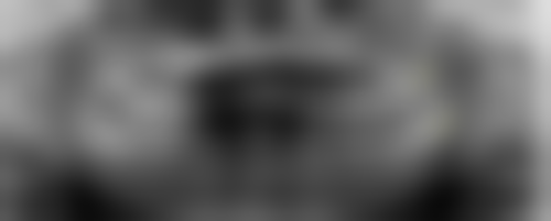 【张帆医生擅长项目】