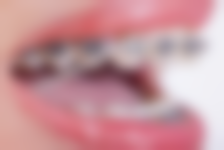 【哈尔滨拜博口腔(文昊门诊店)患者口碑评价:】