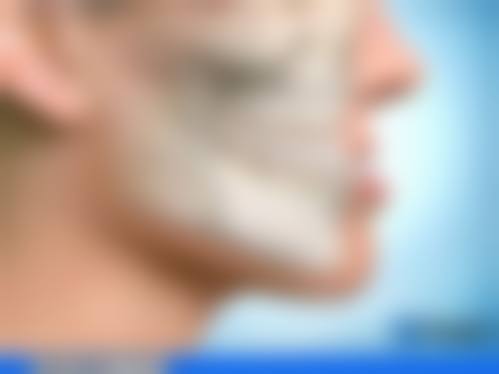 【邹永巍医生擅长项目：】