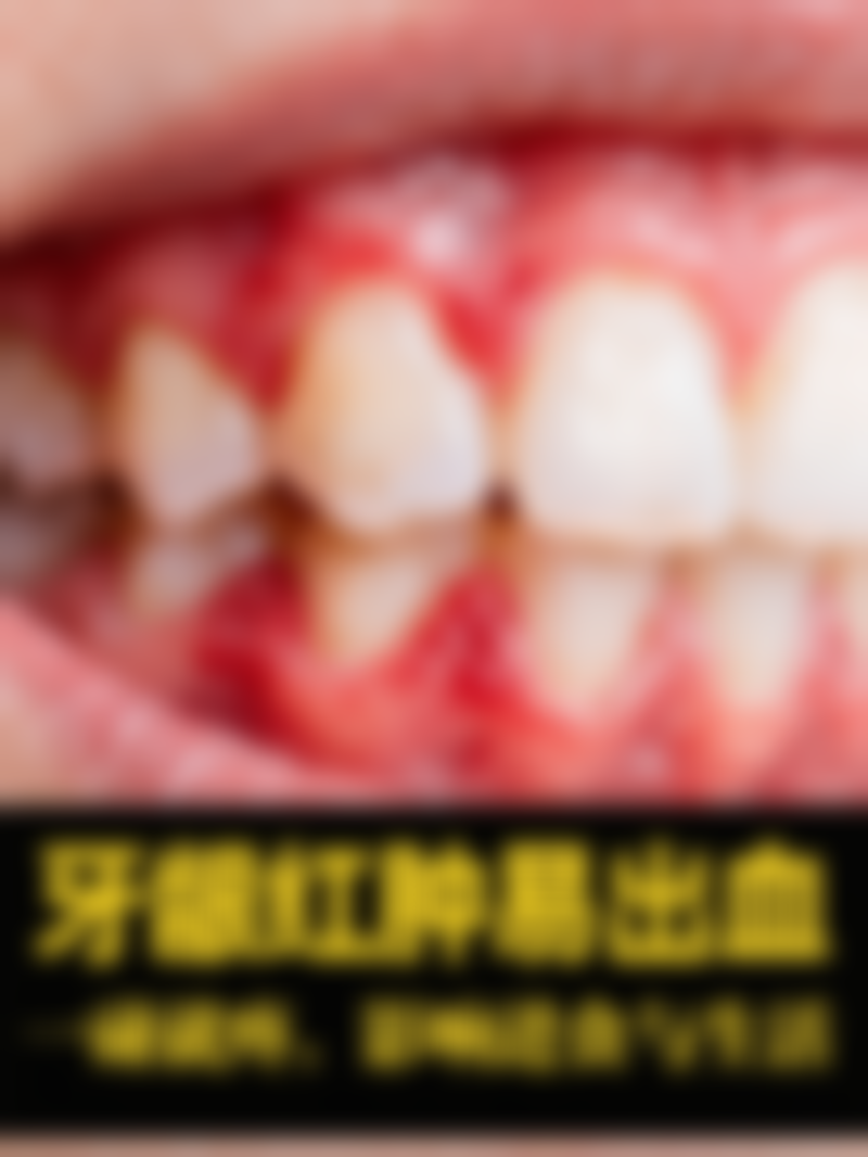 其他口腔问题及治疗方法