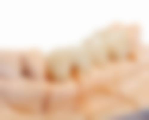 【王爽医生技术特点】