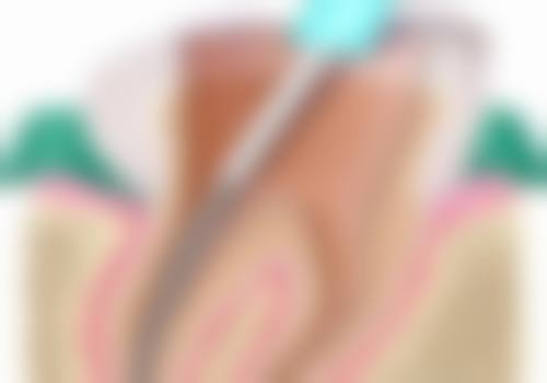 【李海鹰医生口碑怎么样？】