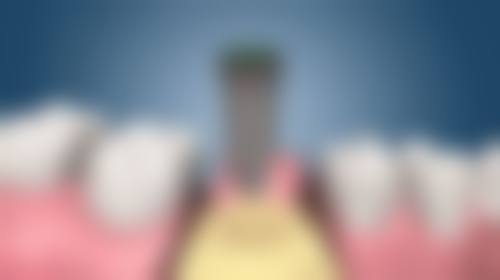 孩子地包天几岁矫正牙齿比较合适