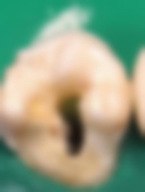 【周阳医生口碑怎么样?】