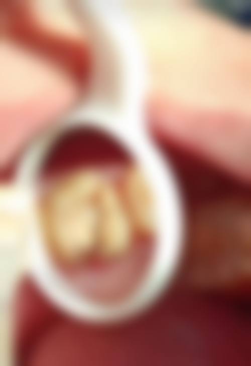 【林闽医生怎么预约挂号?】