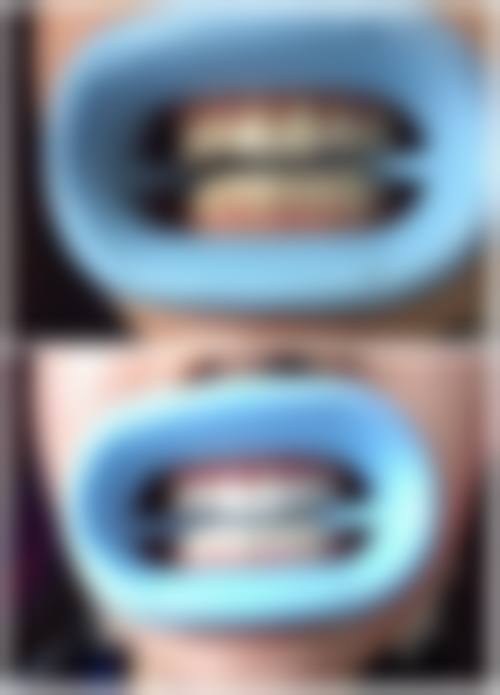 【佳木斯张胜男口腔怎么预约挂号?】