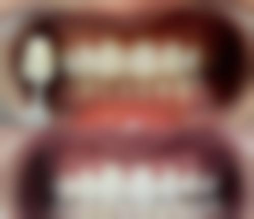 【林闽医生擅长项目】