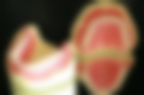 即刻种植的优缺点分析