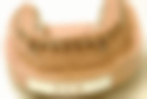 地包天矫正视频全过程