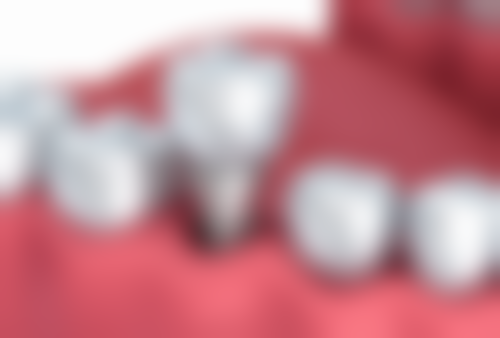 【高恩峰医生怎么预约挂号？】