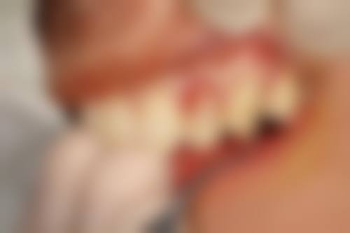 【徐晓薇医生擅长项目】