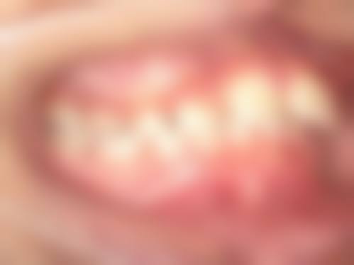 【杨陆一医生擅长项目】