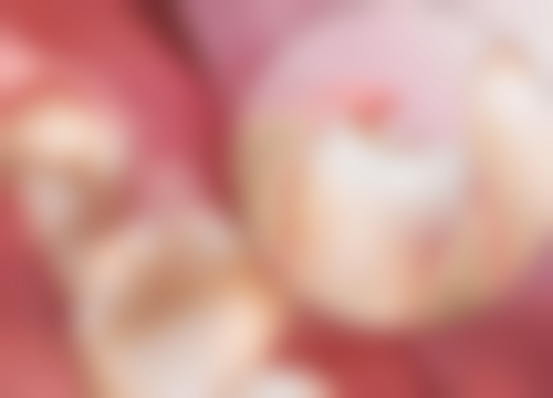 儿童蛀牙疼怎么办