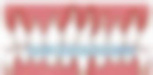 不同种植牙的价格与优势对比