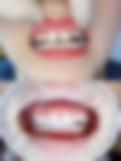 【重庆南岸区黄先凡口腔诊所患者口碑评价：】