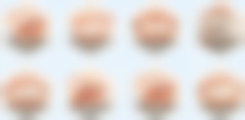 活动义齿和种植牙的优缺点对比