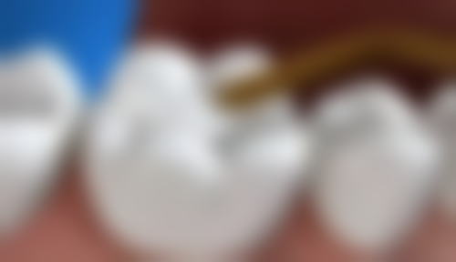 【陈思宇医生怎么预约挂号？】