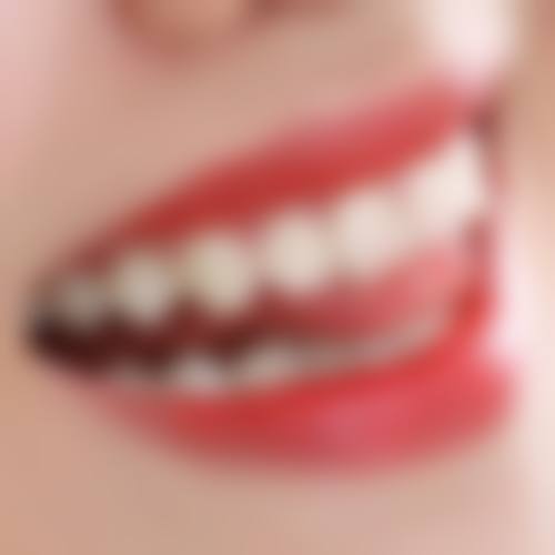 【广西柳州锐达口腔是正规的吗?】