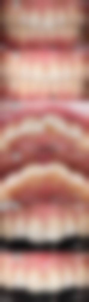 【南京艾芽口腔(江宁店)参考价格表:】