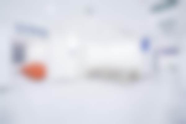 西安双宝口腔医院瑞士E - MAX全瓷牙贴面实例展示