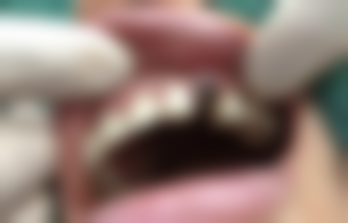 【欧志柏医生口碑怎么样？】