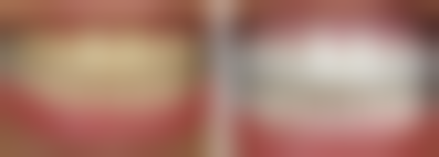 【李珠熙医生口碑怎么样?】