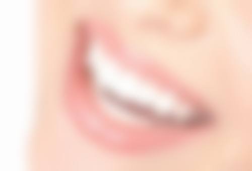 【甘肃陇南礼县康洁美口腔患者口碑评价：】