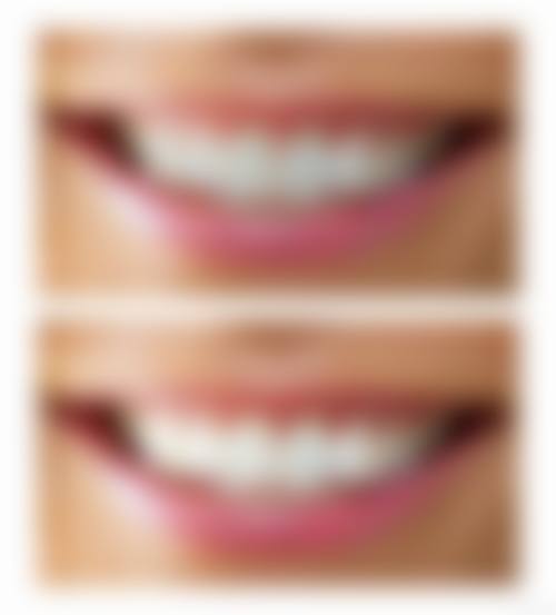 【吴艳芳医生技术特点】