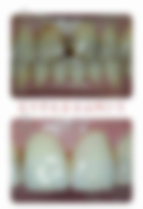 【广东深圳德诺口腔诊疗设备:】