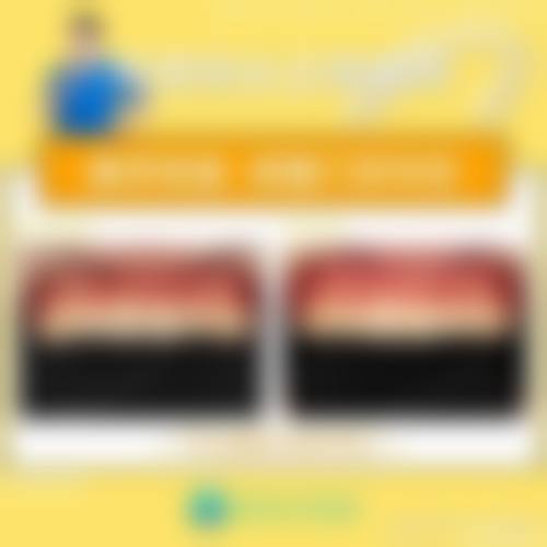 【临沂牙博仕口腔门诊部怎么预约挂号?】