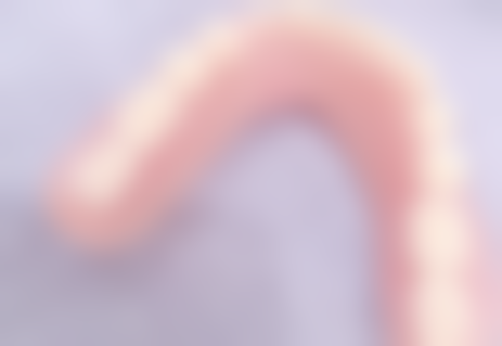 牙齿拔了可以不种牙吗