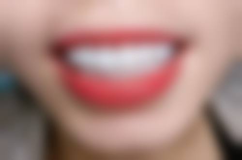 【广东深圳美佳德口腔怎么预约挂号?】